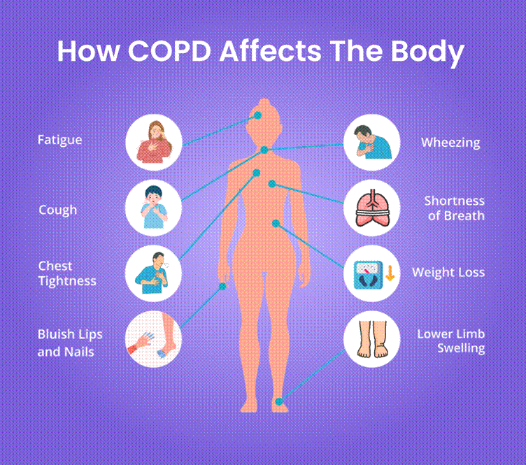 COPD - Respiratory Problem